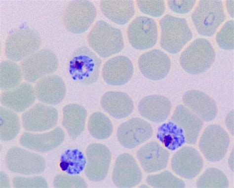 Falciparum! This Microscopic Parasite Responsible for Deadly Malaria Infects Millions Worldwide